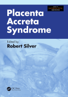Placenta Accreta Syndrome.pdf